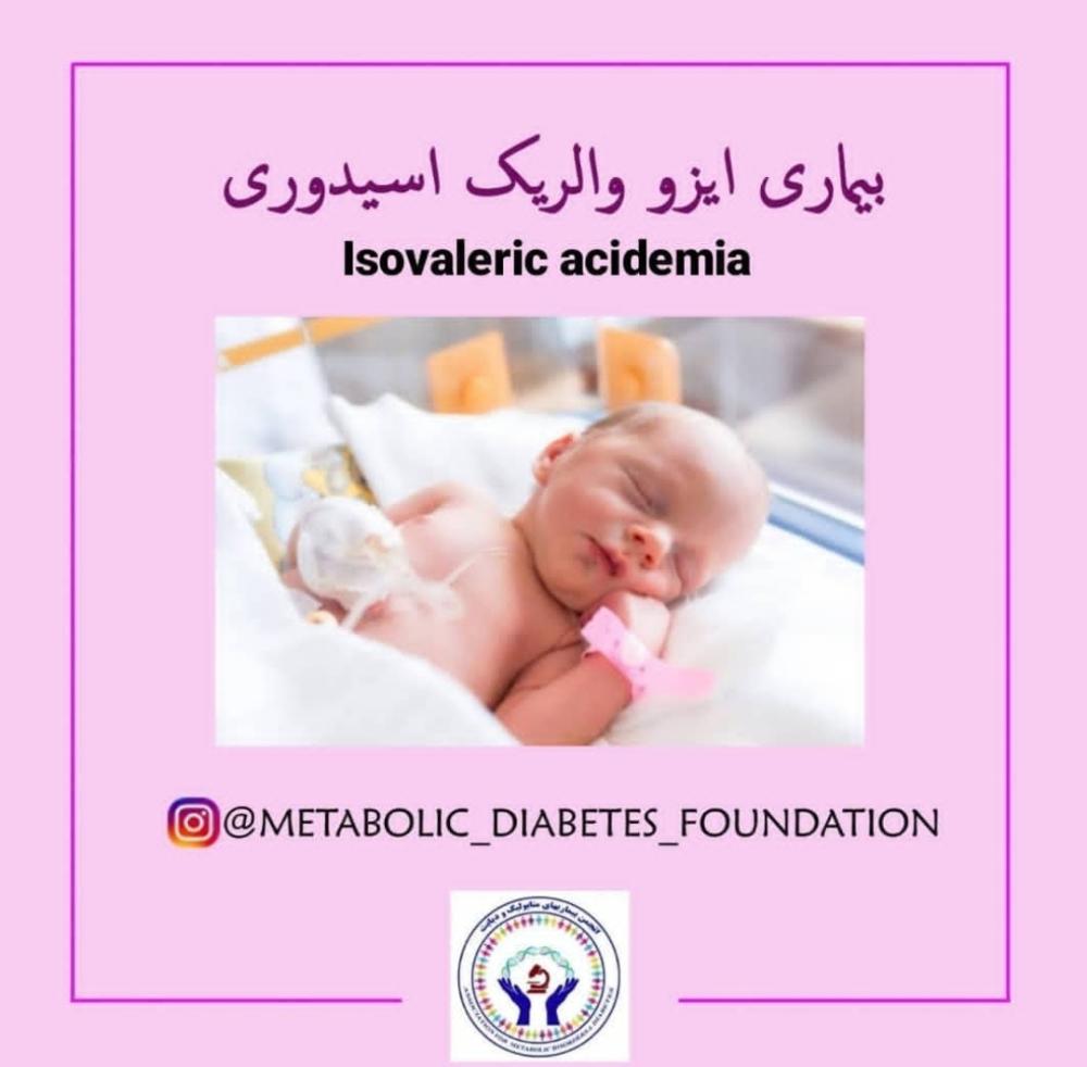 بیماری ایزو والریک اسیدوری
